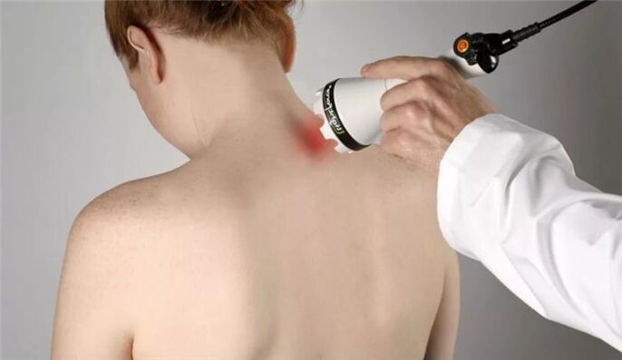 physiotherapy for the treatment of cervical osteochondrosis